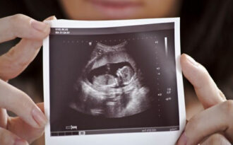 Узи на 20 неделе беременности: выявление патологий